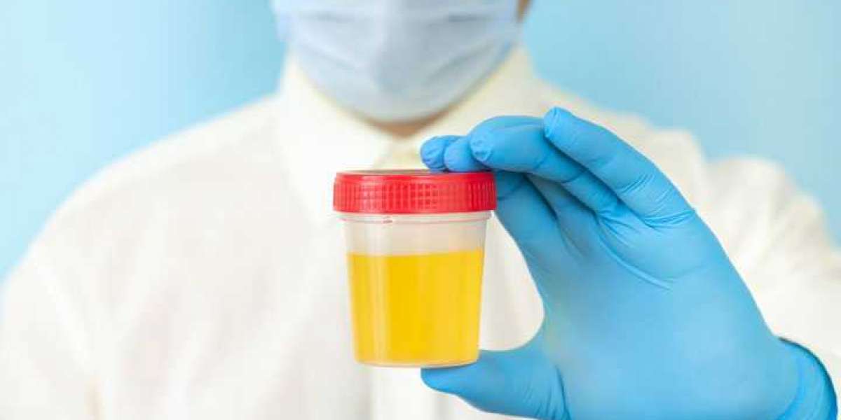 Urinalysis Market : Current Trends and Future Opportunities By 2031