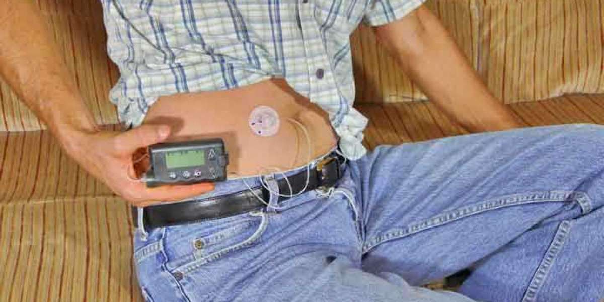 Tubeless Insulin Pump Market Worth to Reach $2,837.6 million by 2031 | Top Companies and Industry Growth Insights