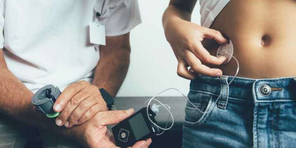 Tubeless Insulin Pump Market 2023 Analytical Assessment, Key Drivers, Growth and Opportunities to 2026